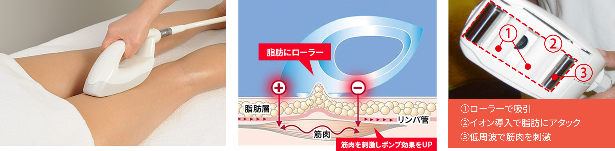 脂肪吸引→脂肪燃焼→引き締め